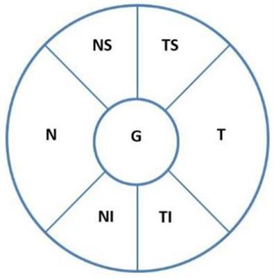 Characteristics of optic disc hemorrhage and optic nerve changes following acute primary angle closure